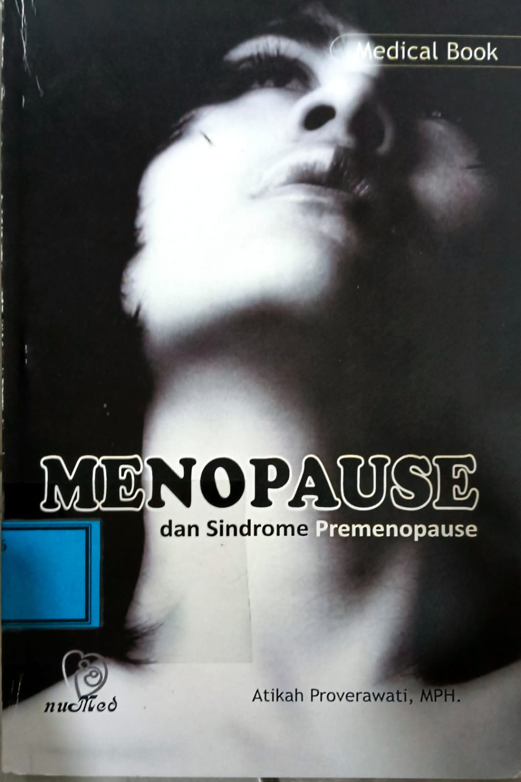 Menopause dan Sindrome Premenopause