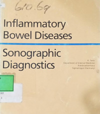 Image of Inflammatory Bowel Diseases Sonographic Diagnostics