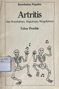 Kesehatan Populer : Artritis Apa Penyebabnya, Bagaimana Mengobatinya